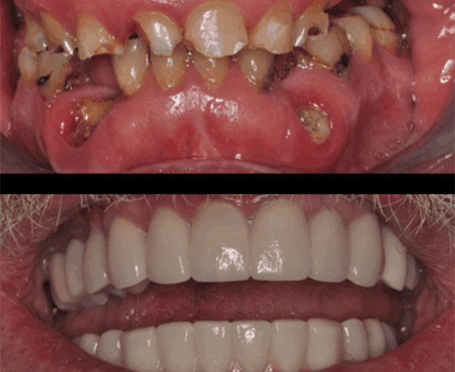 We Accept All Major Dental Insurances and Health Spending Accounts